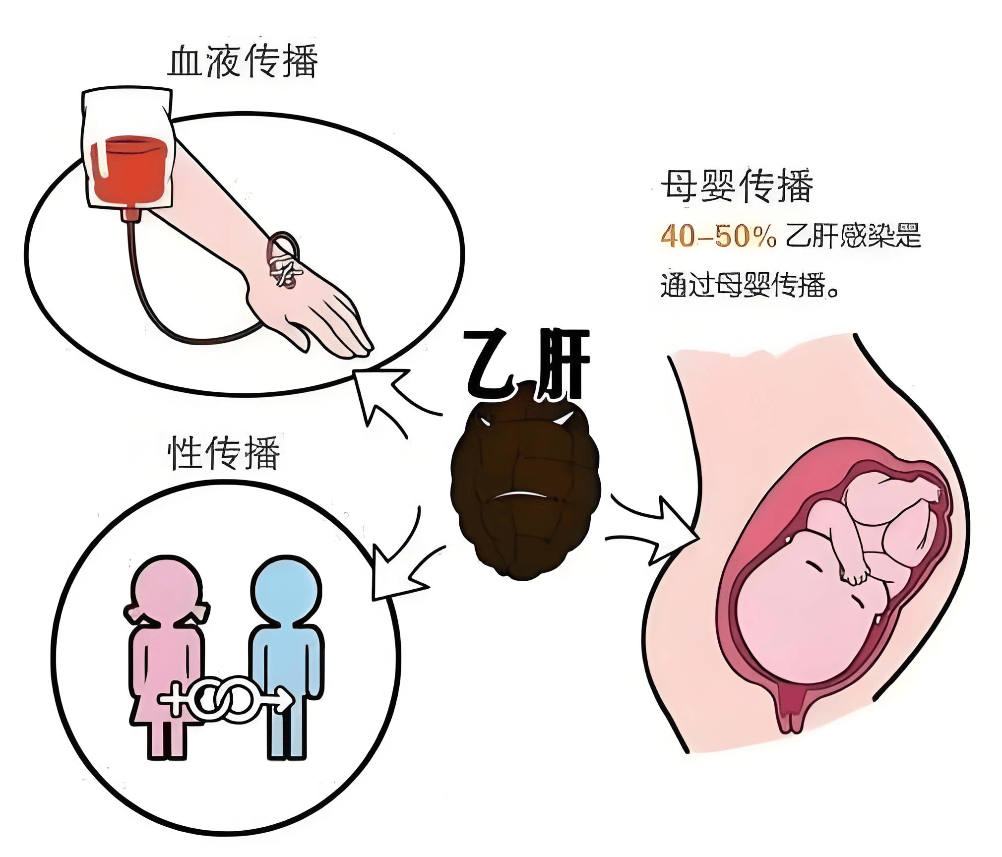 夫妻之间,传染乙肝的几率大吗?