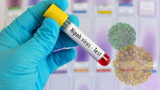 印度这致死率75%的尼帕病毒 真的会成为下一个新冠吗