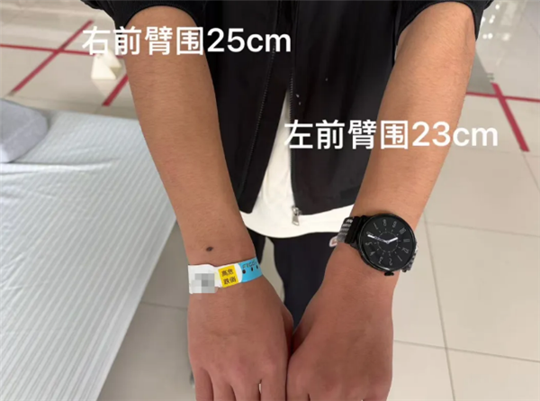 高中生左手莫名发抖半年确诊平山病:长期保持错误坐姿